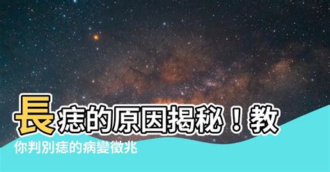 如何避免長痣|避免長痣的10大秘訣